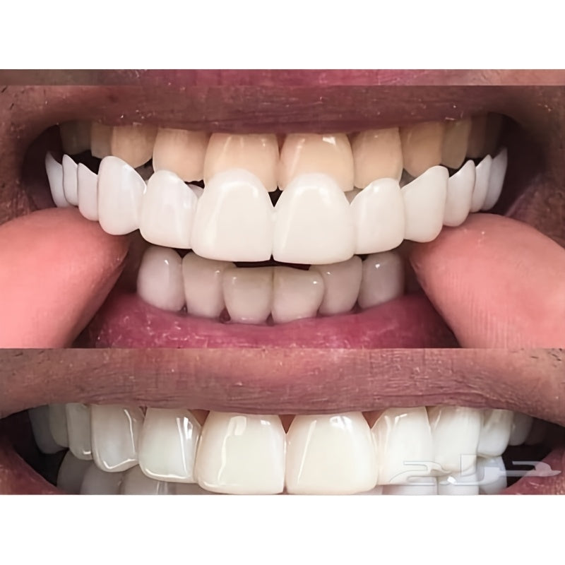 4-teiliges Dental-Set | Flexibler Einweg-Zahnersatz | Inklusive Aufbewahrungsbox
